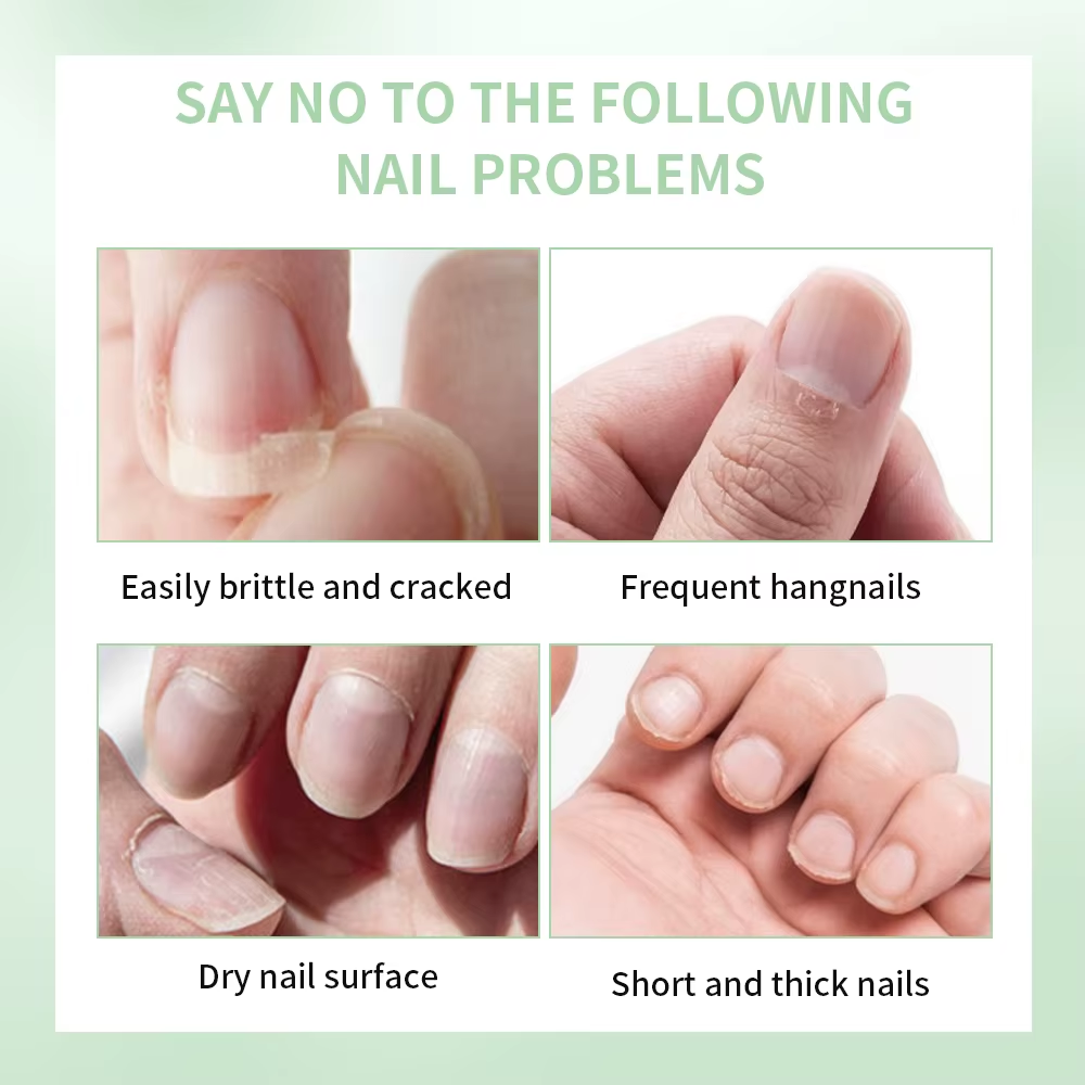 Nail Treat -Growth Nail Strengthener Healthy Strong Nail Growth Oil Help Splits Thin Nails Repair Manicure Nail Hardener Polish